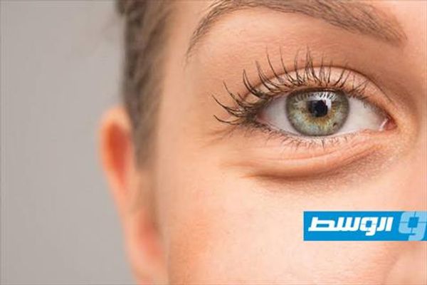 خلطة منزلية سهلة للتخلص من انتفاخ العيون