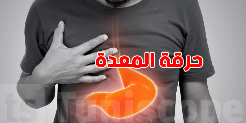 حرقة المعدة في العيد: سبب القلق وكيفية الوقاية