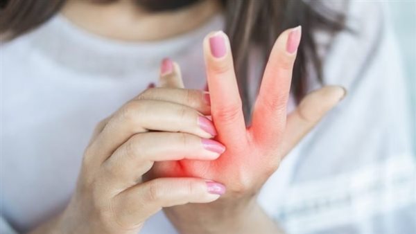 نصائح تخلصك من حكة اليدين الناتجة عن جفاف الجلد