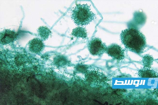 فطر «أسبرجيلوس».. لغز الوفيات في مستشفى سيدني وخطر «العفن الشائع»