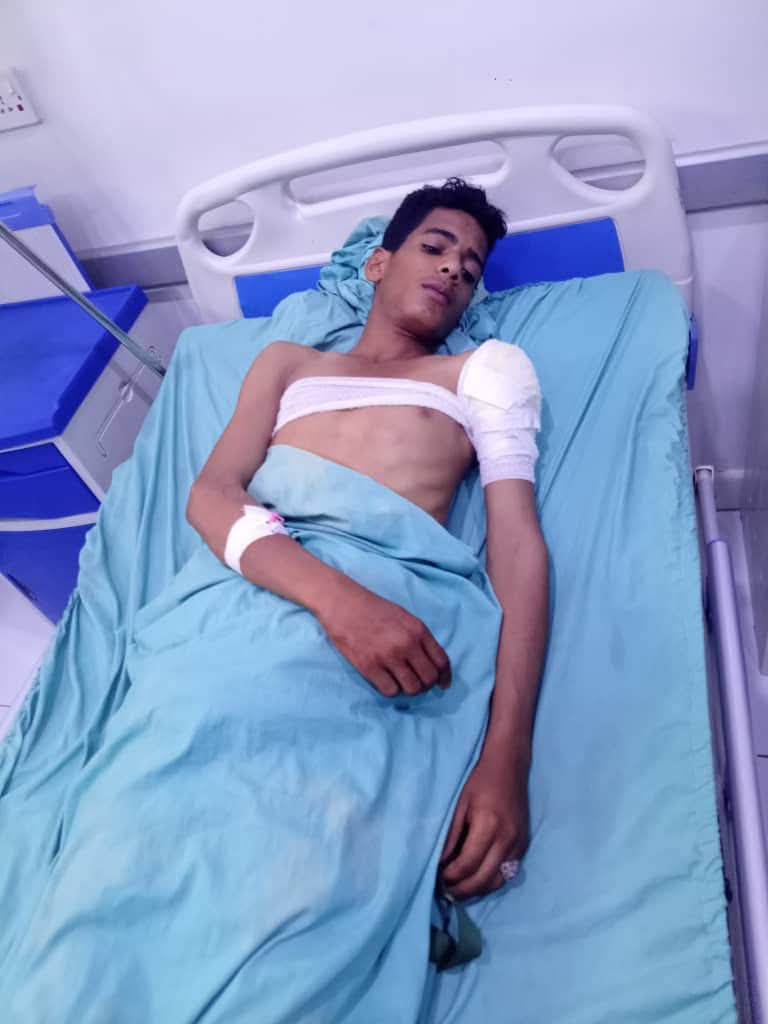 لحج .. إصابة فتى بقصف عشوائي شنته مليشيا الحوثي على قرى المسيمير