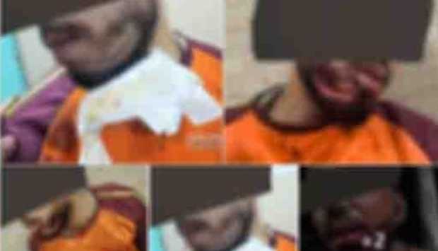 سقوط شخصين تسببا في جرح قطعي لعامل توصيل بحدائق القبة