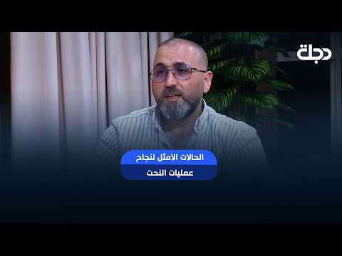 دكتور محمد القيسي يشرح الحالات الامثل لنجاح عمليات النحت