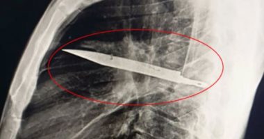 النيابة تستعلم عن الحالة الصحية للمجنى عليه فى واقعة طعن زوجته له بأكتوبر