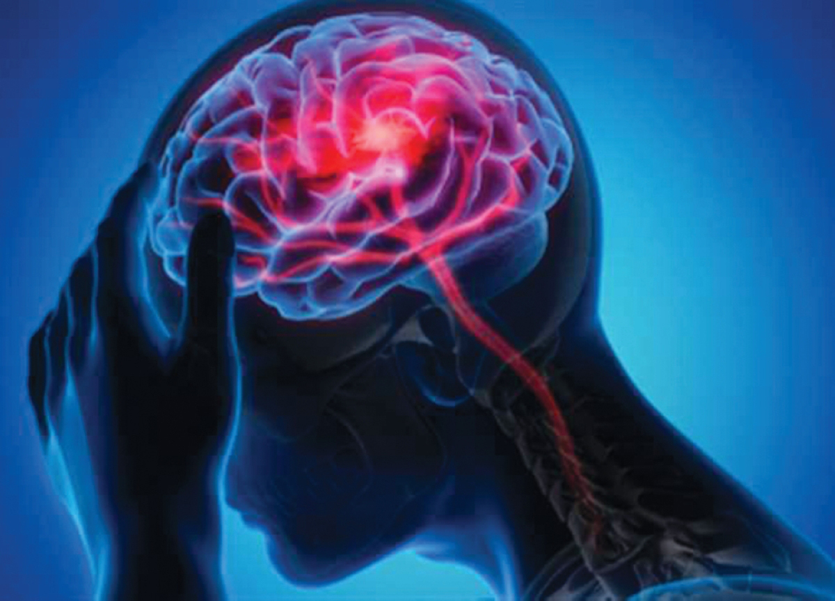 بحث طبي يفتح مساراً جديداً لعلاج أخطر أورام الدماغ