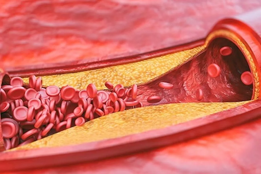 وجبة العشاء لمرضى الكوليسترول- إليك الأطعمة المسموحة